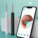 Lyvos™ – O Removedor de Cera com Câmera HD